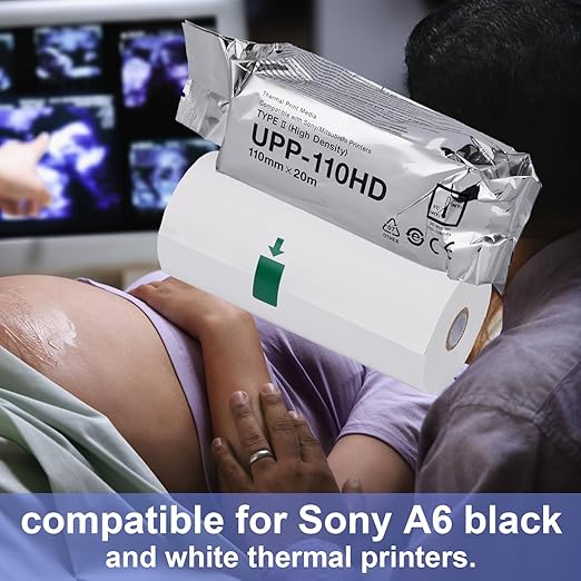 UPP-110HD Ultrasound Paper, 2 Roll High Density Ultrasound Thermal Print Film/Media 110mm x 20m