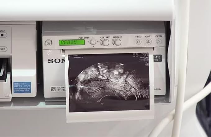UPP110HG High Gloss Video Ultrasound Printer Paper Type V Black and White Thermal Film Compatible for Sony UPP-110HG 110mm x 18m (10 Rolls)