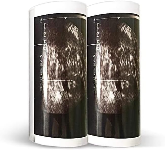 UPP-110HG Ultrasound Thermal Paper, High Gloss 110 Film for Sony/Mitsubishi Printers, Fetal Monitor Paper Roll (110mmx18m, 10 Rolls/Box)
