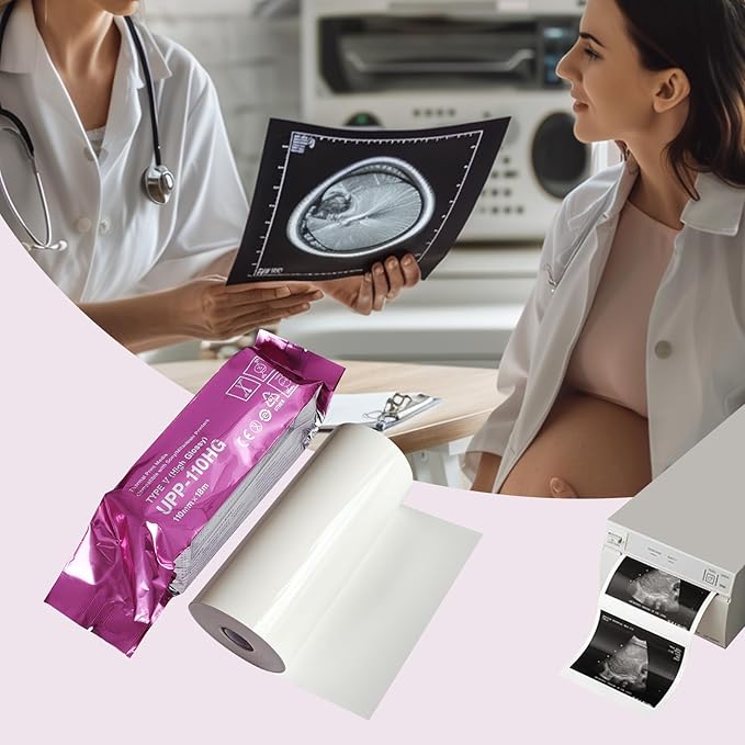 UPP-110HG Ultrasound Thermal Paper, High Gloss 110 Film for Sony/Mitsubishi Printers, Fetal Monitor Paper Roll (110mmx18m, 10 Rolls/Box)